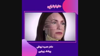 معجزه جوانسازی با هایفوتراپی