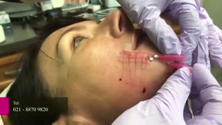 جاگذاری نخ PDO برای خط ماریونت