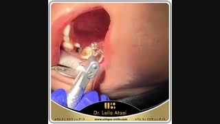 در Unique Smile جدید ترین‌ها و مفید ترین‌ها را در کنار هم تجربه می کنیم | دکتر لیلا عطایی