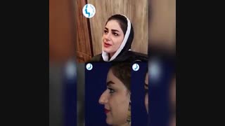 رضایت بیمار بیست روز بعد از جراحی بینی