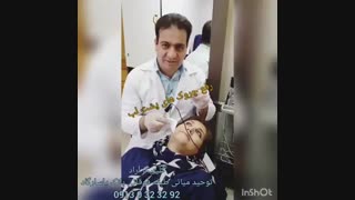 رفع چروک های صورت با بوتاکس اتوپلاستی