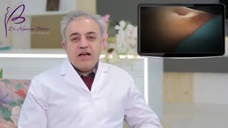 نانوفت چیست؟ لیپوست