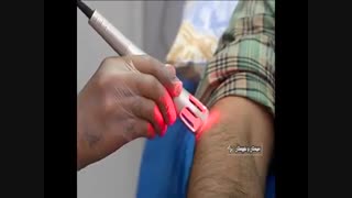 فیزیوتراپی در منزل شیراز