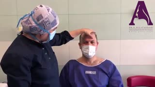 فیلم عمل جراحی پلک و لیفت ابرو