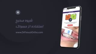 یکی از مهمترین اصول در ارتودنسی رعایت بهداشت در طول درمان است | دکتر فیروزی