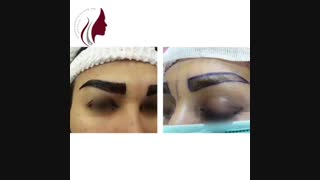 فیلم واقعی کاشت ابروی طبیعی