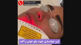 باز سازی سطح پوست به کمک لیزر