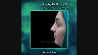 جراحی بینی | فوق تخصص جراحی پلاستیک | دکتر عبدالرضا روئین تن