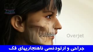 درمان ناهنجاریهای فک ارتودنسی همراه جراحی فک می باشد | دکتر احسان مهریزی