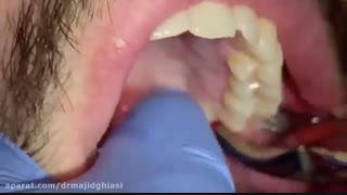 جراحی دندان-دکترمجیدقیاسی