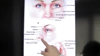 آناتومی طبیعی بینی