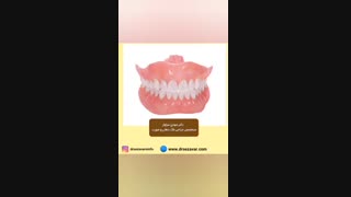 ایمپلنت و دندان مصنوعی
