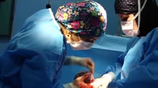 نحوه زایمان سزارین