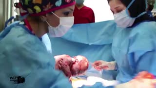 فیلم زایمان سزارین با دکتر حاجیها