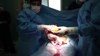 جراحی زایمان سزارین در تهران