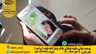 بازسازی پوست صورت ارتودنسی