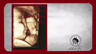 سونوگرافی چهار بعدی