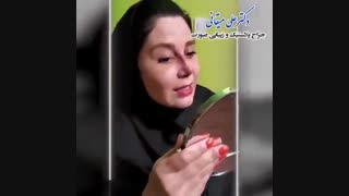 5 روز بعد از جراحی زیبایی بینی