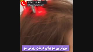 لیزر تراپی برای درمان ریزش مو