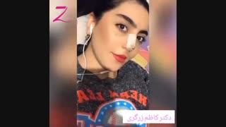 جراحی بینی مرحله به مرحله تا بهبودی کامل