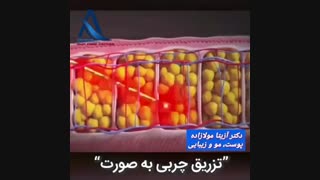 انیمیشن مراحل تزریق چربی به صورت لمینت