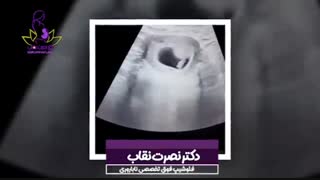 فیلم سونوگرافی حاملگی دو قلویی در فردی با ivfبا تخمک اهدایی