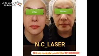 مرکز تخصصی لیزر پوست و مو N.C در بندر امام خمینی ترمیم زیبایی دندان