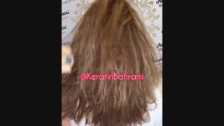 امگا 3 تراپی