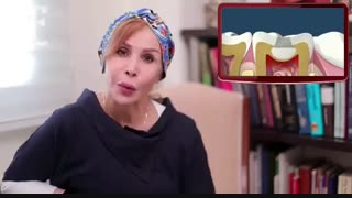 پرکردن دندان با آمالگام