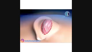 انیمیشنی درباره جراحی زیبایی گوش
