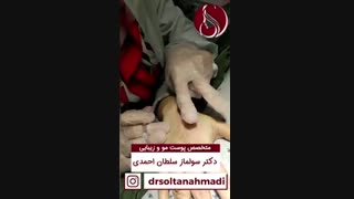 فیلم واقعی مزونیدلینگ