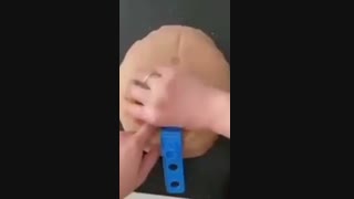 نحوه عمل سزارین