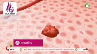 آمار شیوع سرطان سینه