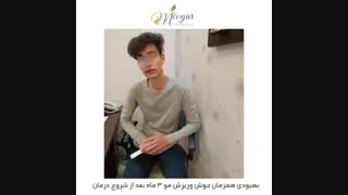 بهبودی همزمان جوش و ریزش مو