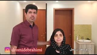 رضایتمندی پنج روز بعد از عمل بینی توسط دکتر امید ابراهیمی بهترین جراح بینی در تهران