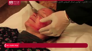 درمان لکه های پوستی با انجام درمارولر تزریق بوتاکس