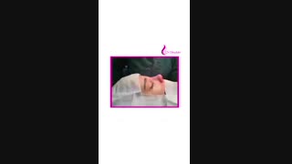 بلافاصله بعداز جراحی بینی