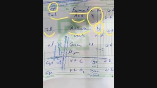 نسخه خوانی با نسخه پزشک قلب