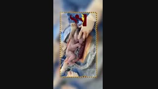 گریه نوزاد بدو تولد خوب یا بد ؟