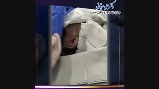 فیلم جراحی بازسازی و ترمیم گوش