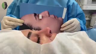 جراحی ترمیمی بینی مشکل با تکنیک انحصاری دکتر باستانی نژاد