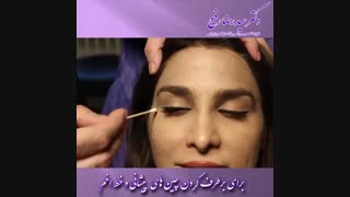 تزریق بوتاکس پیشانی توسط دکتر سید رضا رفیع | جراح پلاستیک تهران