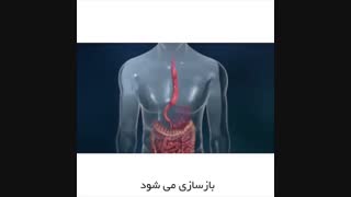 التهاب مری جراحی لثه