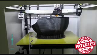 کاشت مو به روش SFT