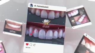 دکتر حامد صالحی دندانپزشکی زیبایی و ایمپلنتولوژیست اصلاح طرح لبخند
