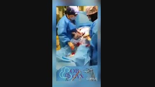 فیلم زایمان سزارین