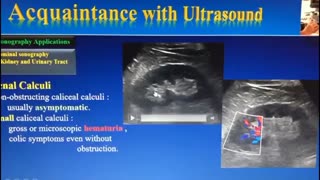 چالش های تشخیص سنگ کلیه در سونوگرافی و فیلم مربوط به آن