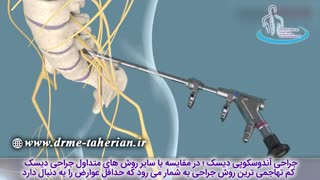 درمان کامل آندوسکوپیک ستون فقرات | متخصص ارتوپد | دکتر محمد ابراهیم طاهریان