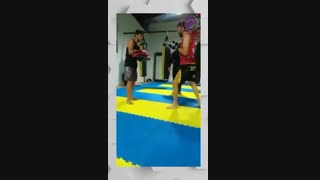 5ماه بعد از شکستگی استخوان