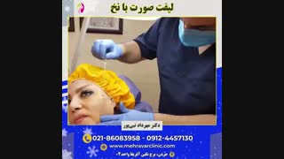 لیفت صورت با نخ